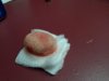 bladder stone 1.jpg