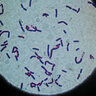 bacillus cereus