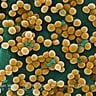 Staphylococcus Aureus