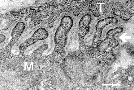 Electron_micrograph_of_neuromuscular_junction_%28cross-section%29.jpg