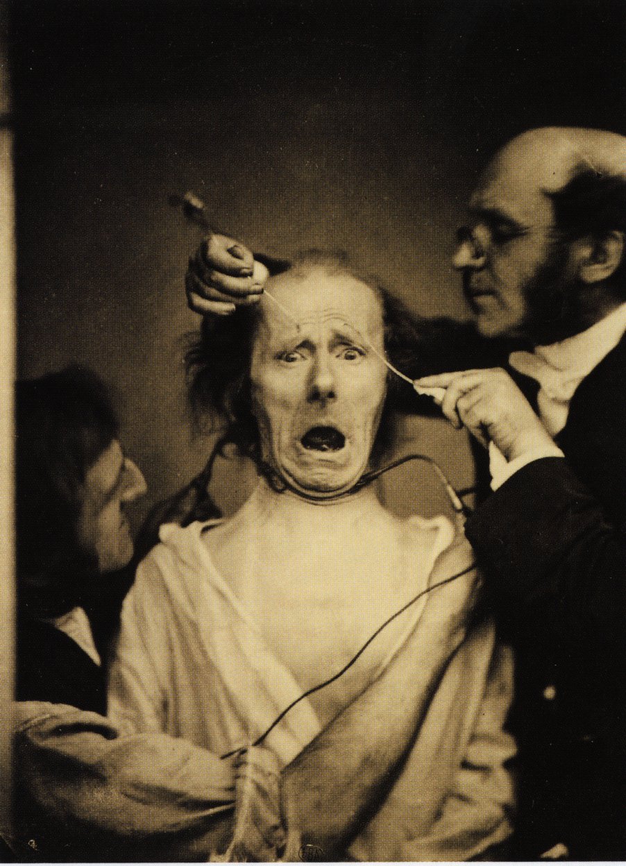 Guillaume_Duchenne_de_Boulogne_performing_facial_electrostimulus_experiments.jpg