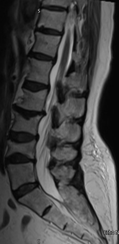 02-19-2023 T2 MRI Image.PNG