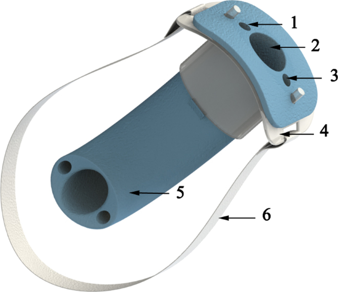 12876_2021_2089_Fig2_HTML.png