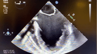 1617395526603.gif
