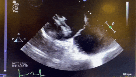 1617500880959.gif