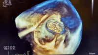 1617500909226.gif