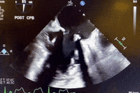 1618625581505.gif
