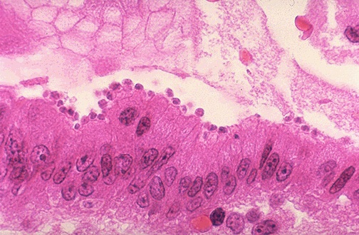 AIDS073.jpg