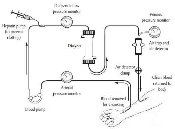 dialysis - source gold standard mcat.jpg