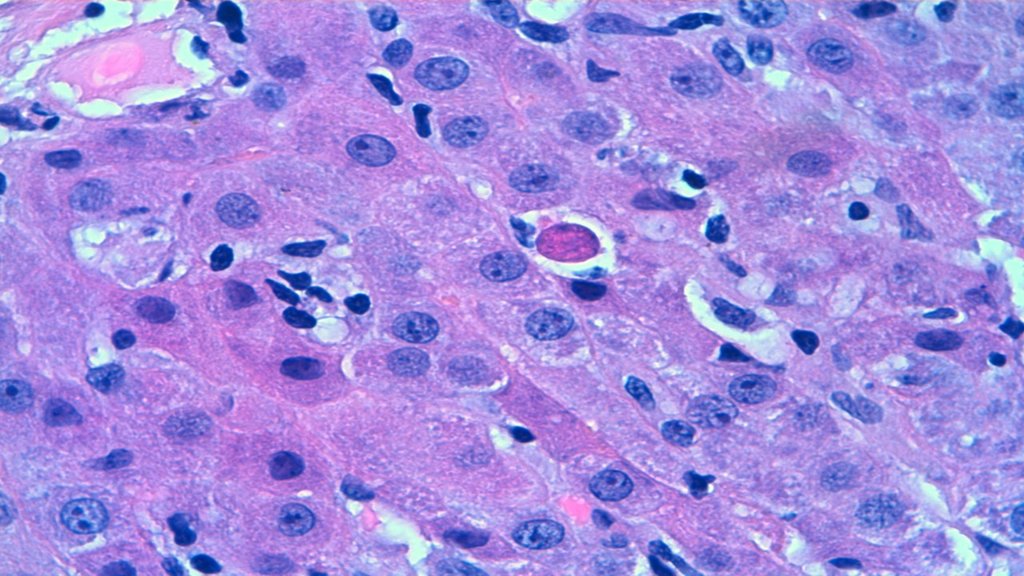 Diapositiva6.JPG