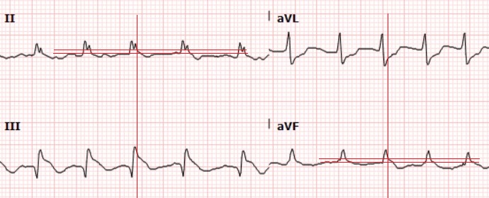 EKG Closeup.jpg