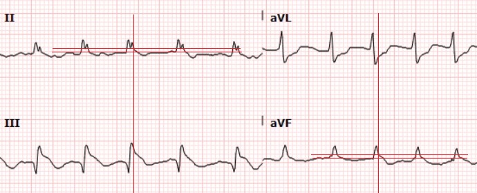 EKG Closeup.jpg