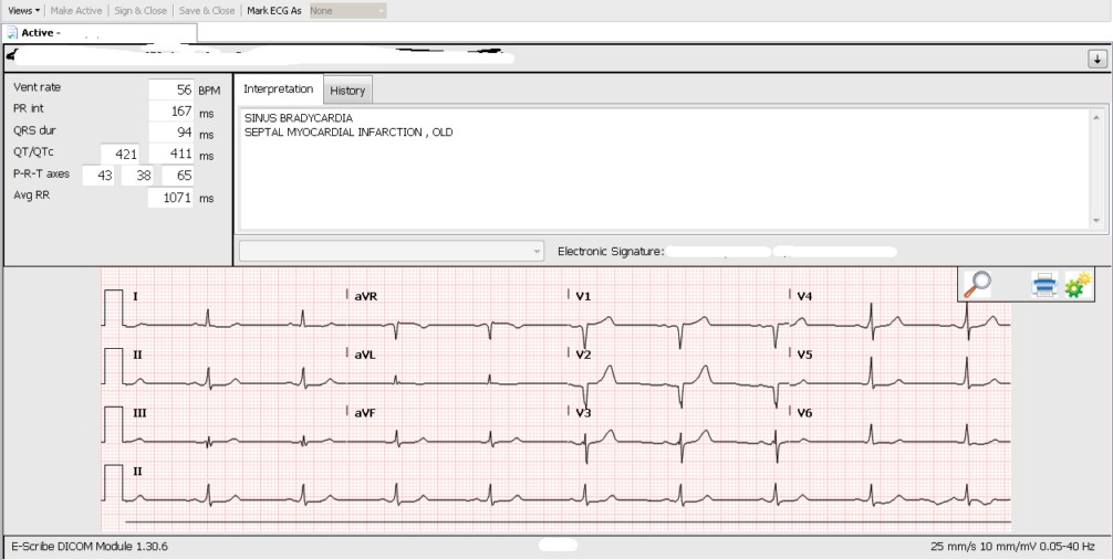 ekg sample.jpg