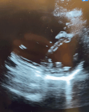 ezgif.com-gif-maker (1).gif