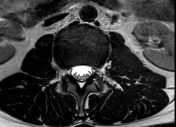 ferret kidney.jpg