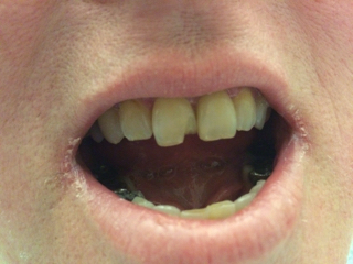 ImageUploadedBySDN Mobile1448404171.580734.jpg