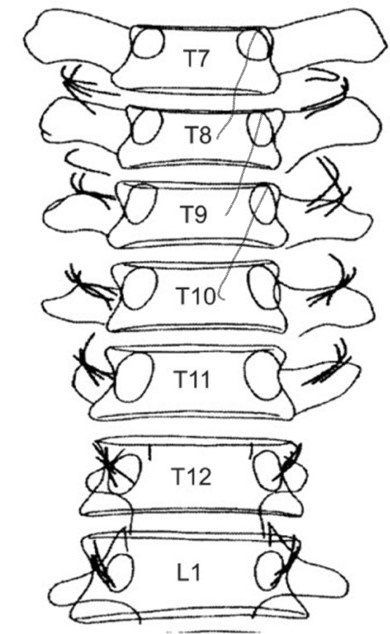 InkedT-spine RF_LI.jpg