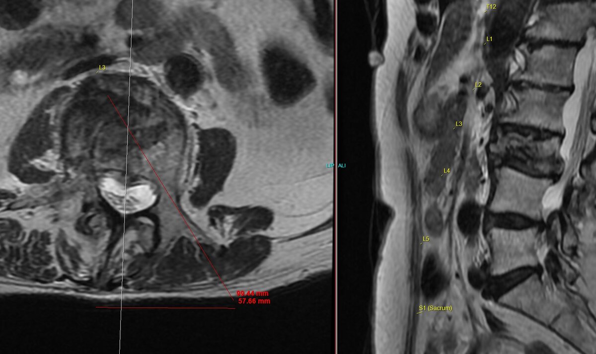 Pictures of the Week | Page 32 | Student Doctor Network Forums