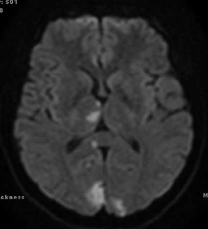 MRI 1.jpg