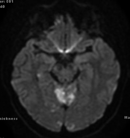 MRI 2.jpg
