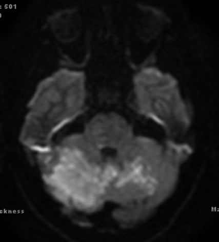 MRI 3.jpg