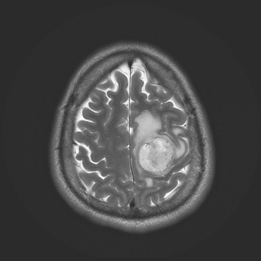 MRI brain.jpg