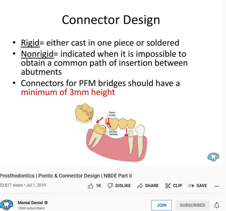 Non-Rigid Connector.png