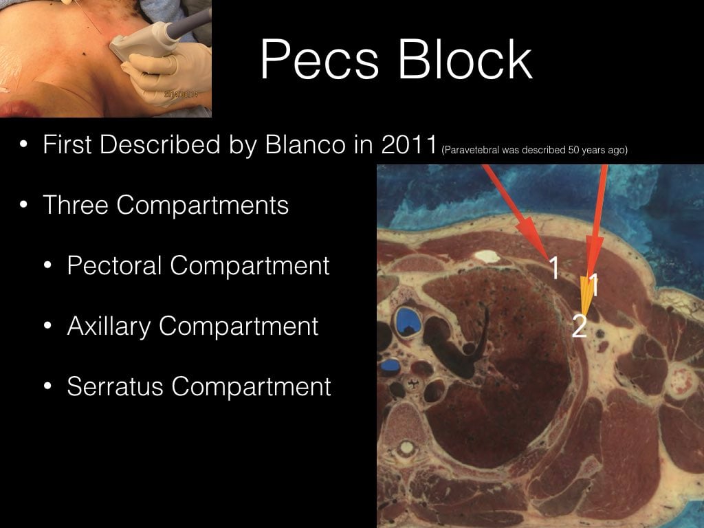 PECS BLOCK.019.jpeg