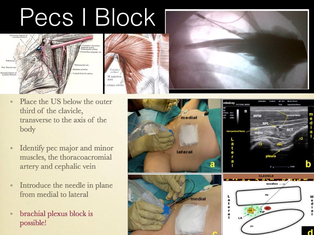 PECS BLOCK.021.jpeg