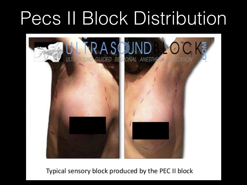 PECS BLOCK.024.jpeg