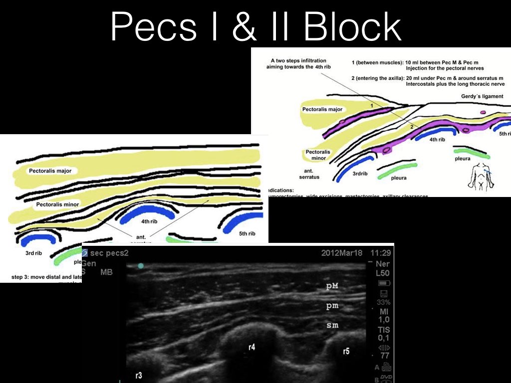PECS BLOCK.026.jpeg