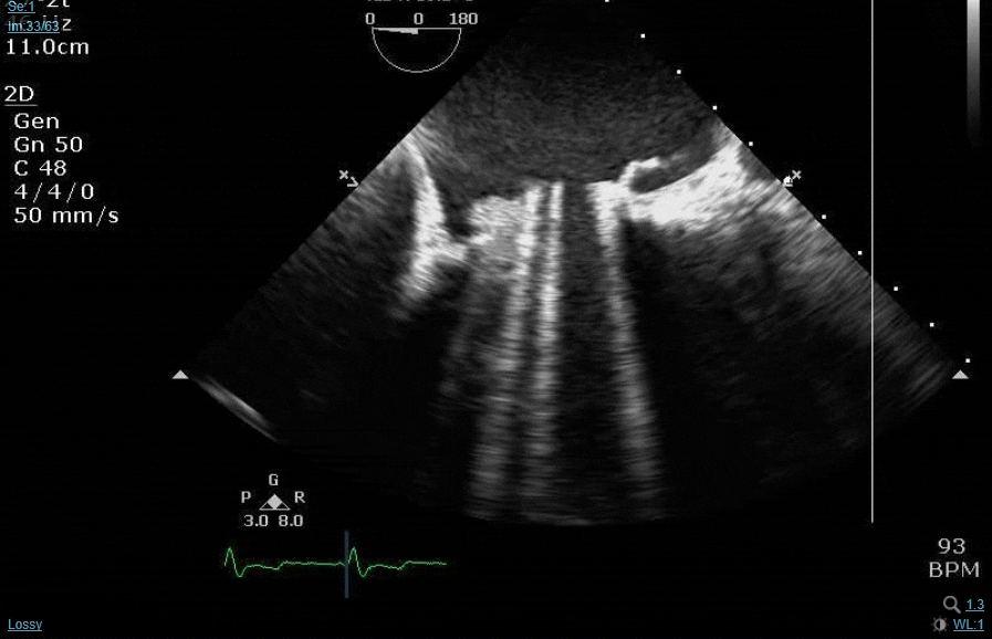 reop mvr1.gif