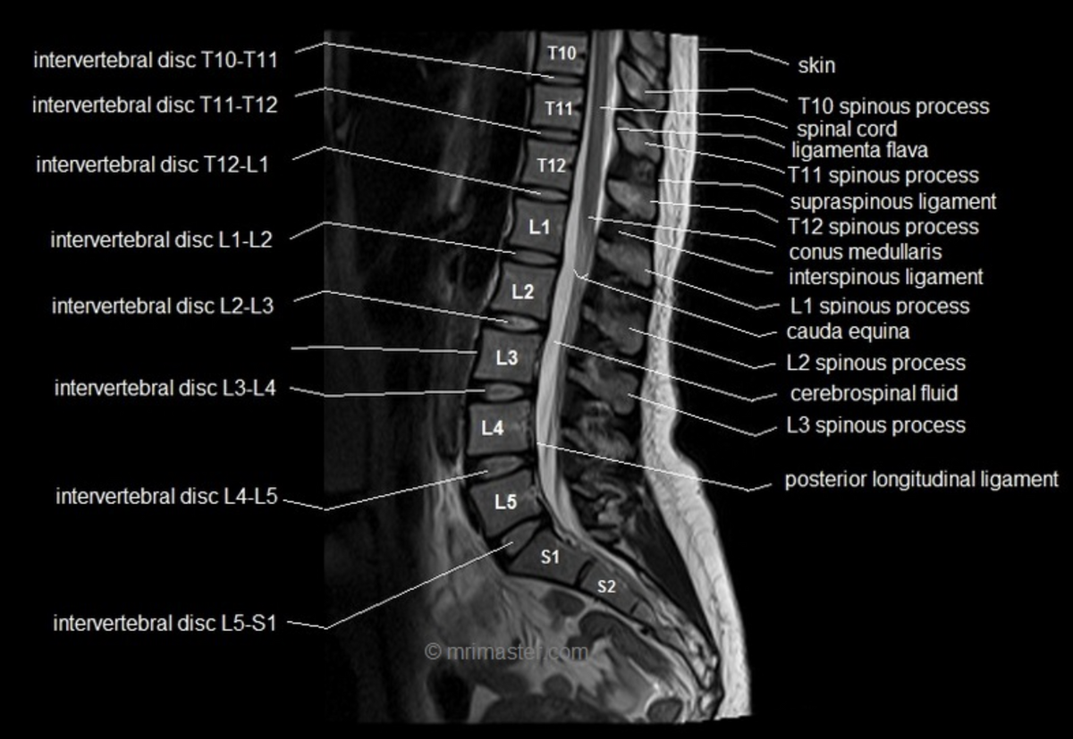 spine.png