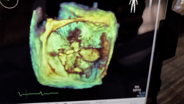vid1.gif
