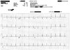 EKG.JPG