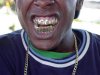 teeth.jpg