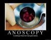 Anoscopy.jpg