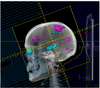hippocampal 3d.png