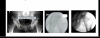 ABFON.png