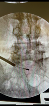 9672B5C5-45B6-4A31-B98E-26C549240E4B.png