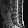 LUMBAR SPINE WITHOUT CONTRAST 0009.jpg