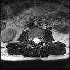 LUMBAR SPINE WITHOUT CONTRAST 0018.jpg