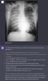 cxr.jpg