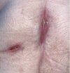 incisions.JPG