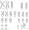karyotype_female.jpg