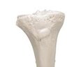 Tibial.Tuberosity