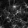 Glioma