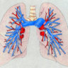 PulmonaryPrincess