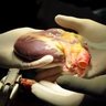 SurgeonsHadAHeartToHeart