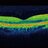 ophthalmicwhat